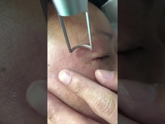 450ps Pikosaniye Lazer Makinesi 1064nm 532nm Q Anahtarlamalı Nd Yag