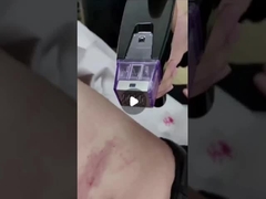 50W Kısmi RF Mikroneedle Makinesi 100V 240V