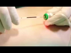 Lazer Lipoliz Makinesi